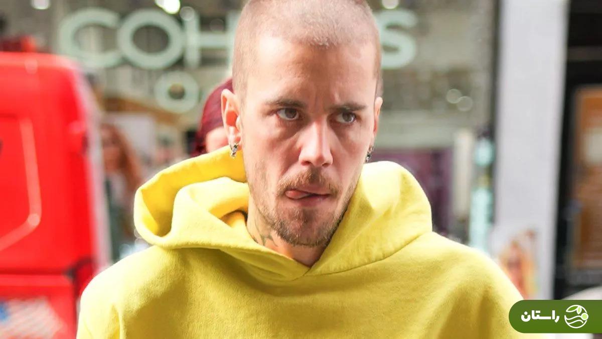 نگرانی طرفداران از ظاهر خسته و نحیف جاستین بیبر