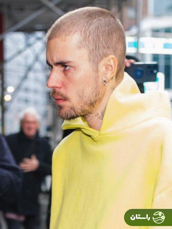 نگرانی طرفداران از ظاهر خسته و نحیف جاستین بیبر