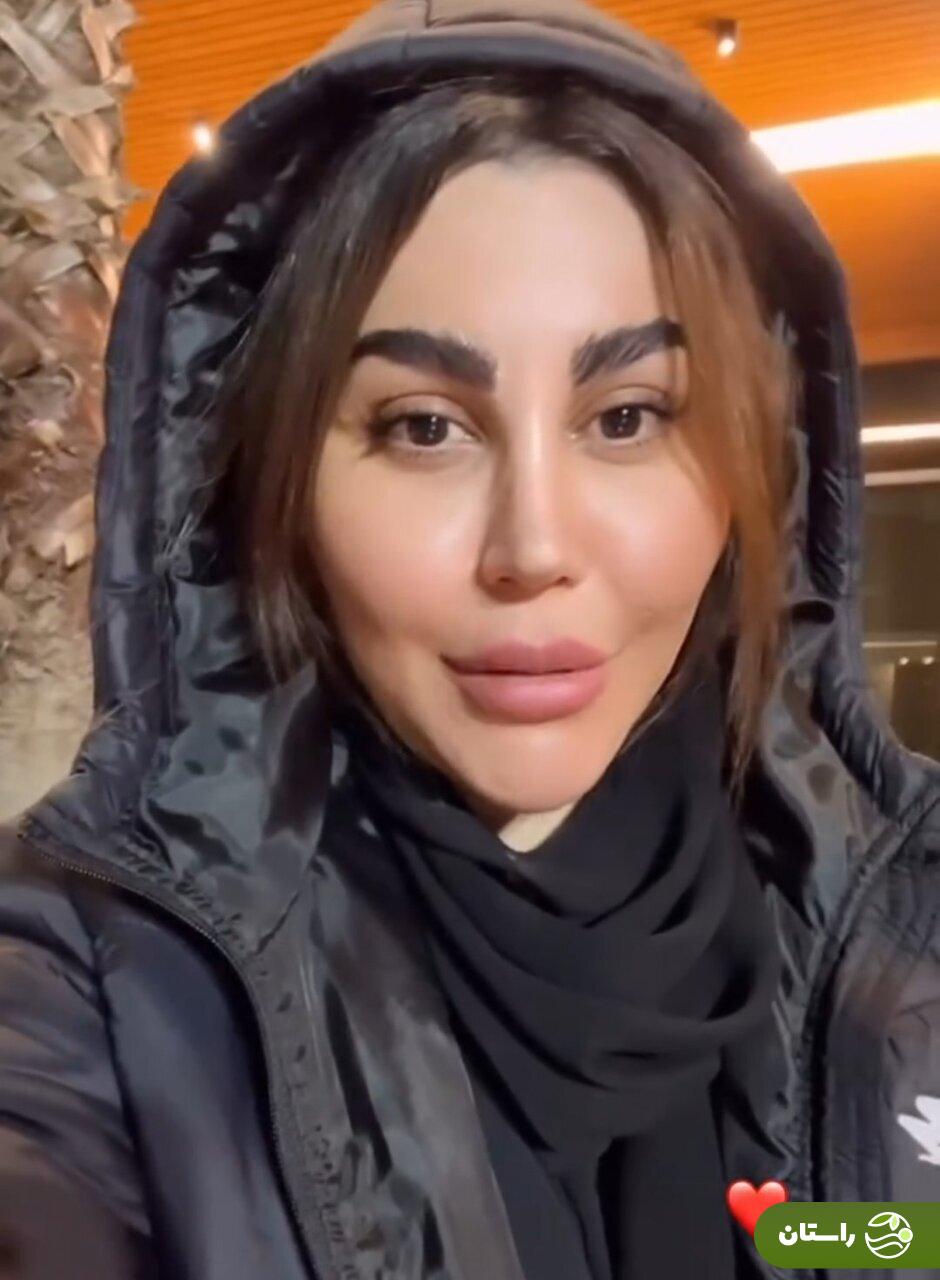 تغییرات اساسی چهره اکرم بیرانوند تغییرات اساسی چهره اکرم بیرانوند