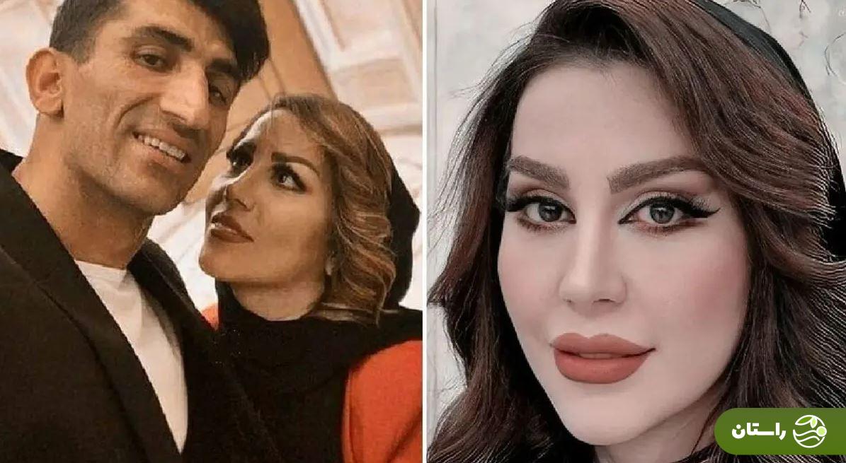 تغییرات اساسی چهره اکرم بیرانوند تغییرات اساسی چهره اکرم بیرانوند