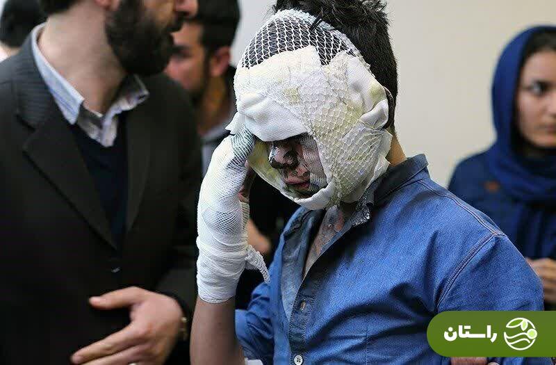 تصاویر +۱۸ و دلخراش از مصدومان چهارشنبهسوری ۱۴۰۳ تصاویر +۱۸ و دلخراش از مصدومان چهارشنبهسوری ۱۴۰۳