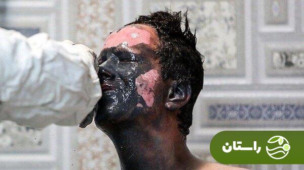 تصاویر +۱۸ و دلخراش از مصدومان چهارشنبهسوری ۱۴۰۳ تصاویر +۱۸ و دلخراش از مصدومان چهارشنبهسوری ۱۴۰۳