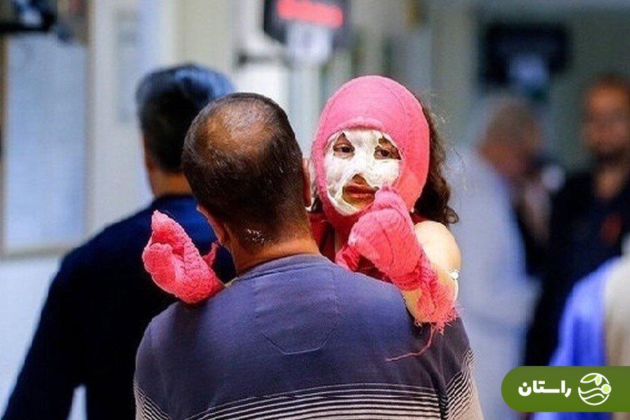 تصاویر +۱۸ و دلخراش از مصدومان چهارشنبهسوری ۱۴۰۳ تصاویر +۱۸ و دلخراش از مصدومان چهارشنبهسوری ۱۴۰۳