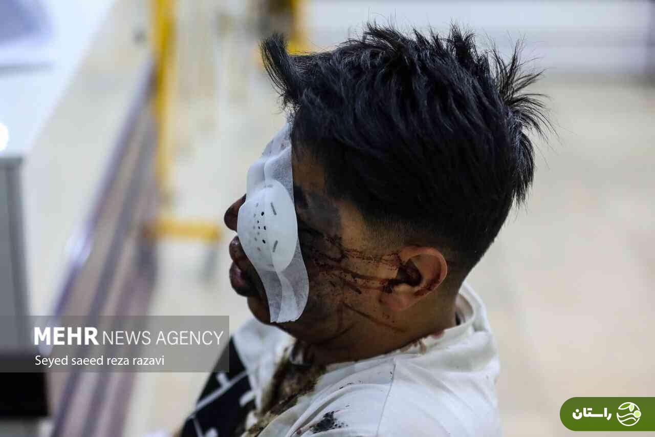 تصاویر +۱۸ و دلخراش از مصدومان چهارشنبهسوری ۱۴۰۳ تصاویر +۱۸ و دلخراش از مصدومان چهارشنبهسوری ۱۴۰۳