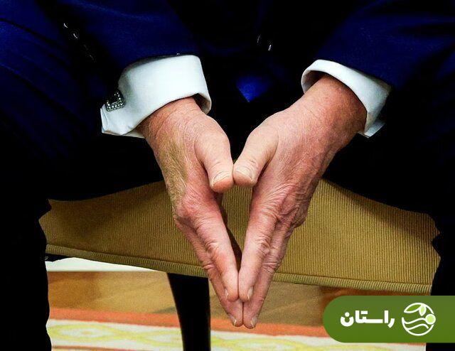 کبودی دست ترامپ جنجال به پا کرد + تصاویر