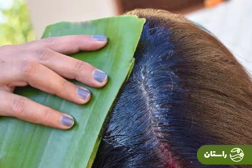 راههای درمان شوره سر چرب خانگی راههای درمان شوره سر چرب خانگی