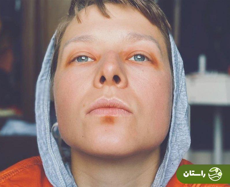 اما دارسی (Emma D'Arcy) بازیگر نقش ملکه رینیرا در خاندان اژد‌ها کیست؟