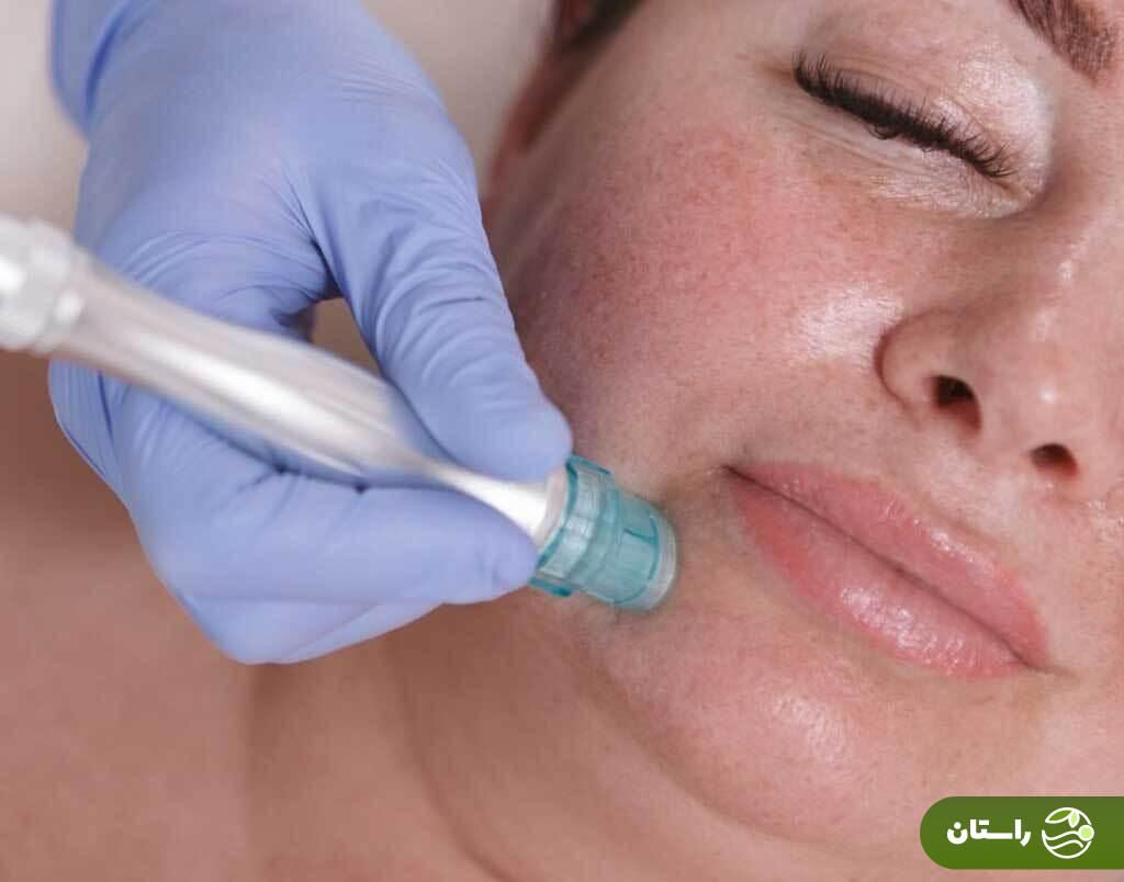 راهو روشهای ساده بستن منافذ پوست را برای داشتن یک صورت زیبا یاد بگیرید راهو روشهای ساده بستن منافذ پوست را برای داشتن یک صورت زیبا یاد بگیرید