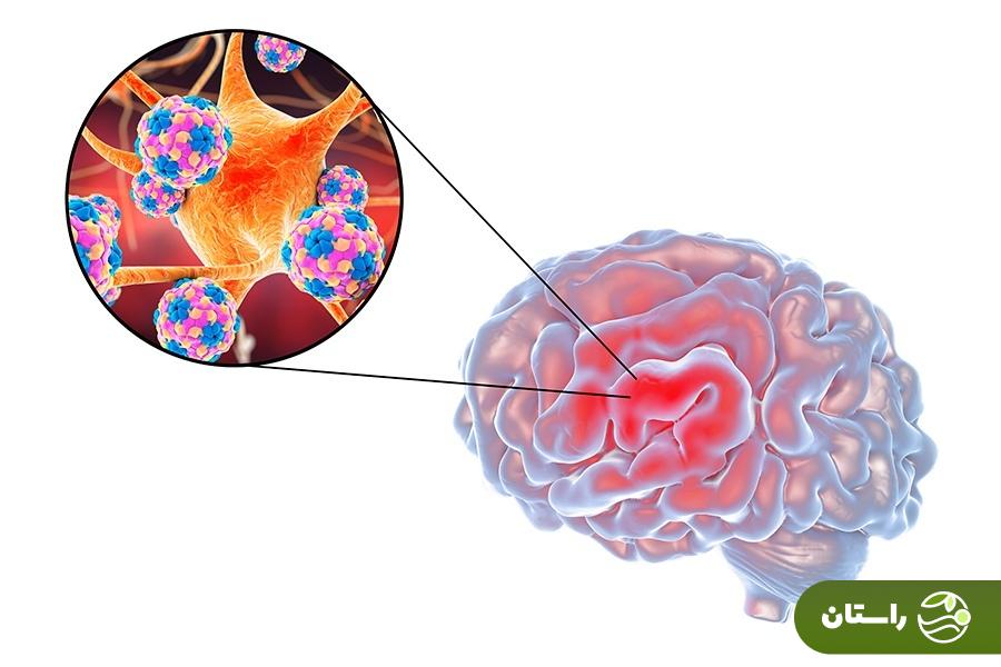عکس | بوسیدن دهان نوزاد ۲ روزه و یک زندگی که خراب شد! عکس | بوسیدن دهان نوزاد ۲ روزه و یک زندگی که خراب شد!