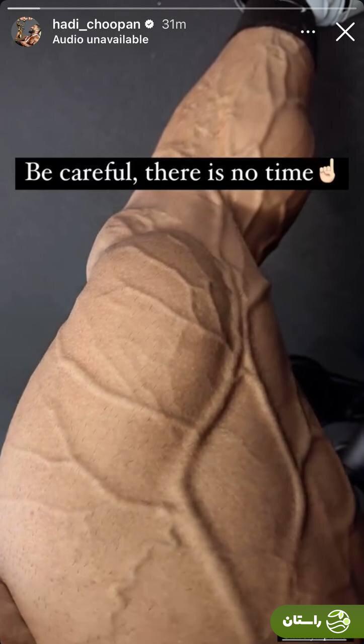 عکس | رجزخواهی هادی چوپان؛ تصویر شگفتانگیز از عضلات گرگ ایرانی عکس | رجزخواهی هادی چوپان؛ تصویر شگفتانگیز از عضلات گرگ ایرانی