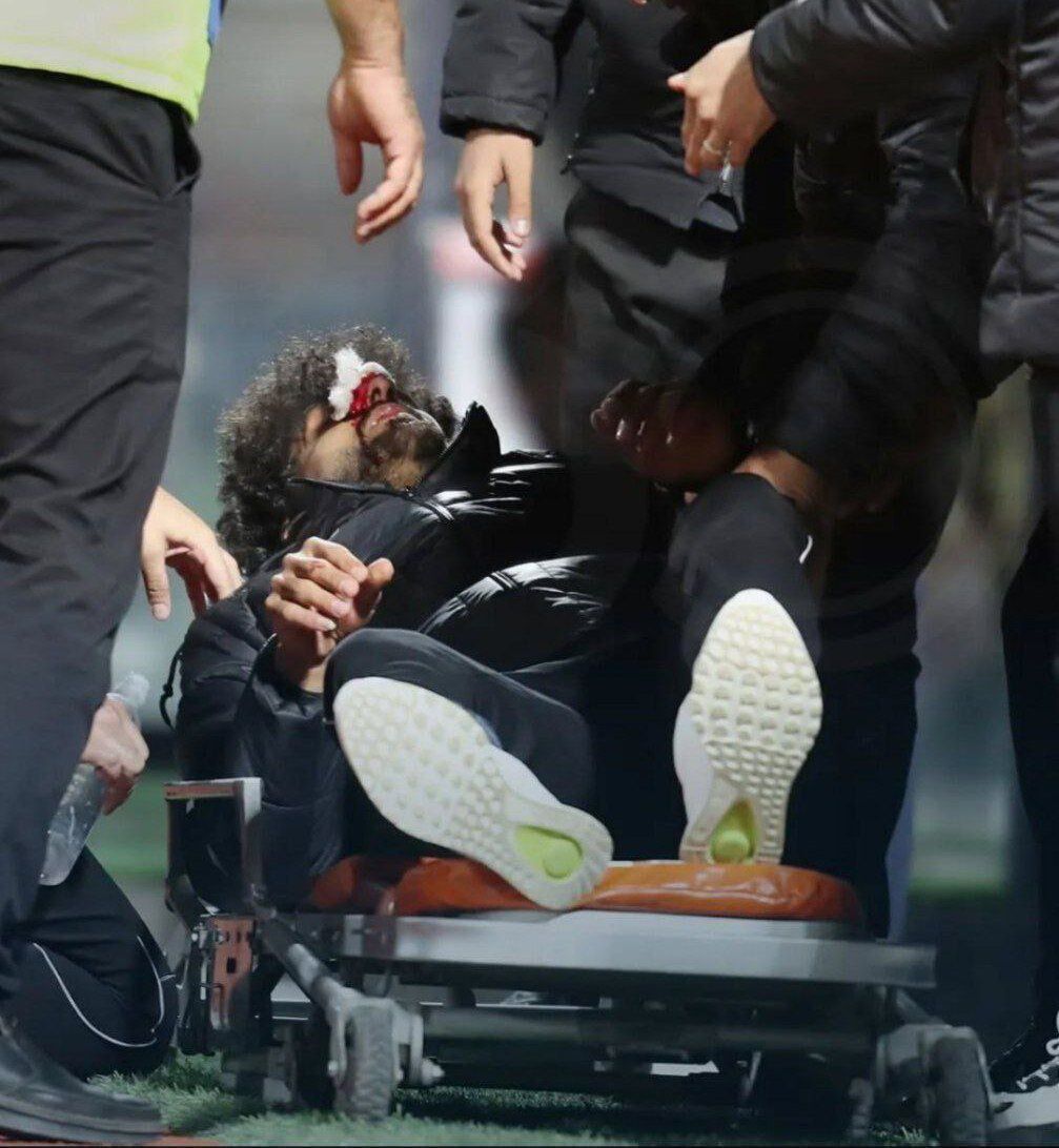 تصاویر | عصبانیت شدید فرشید اسماعیلی و عجیب‌ترین مصدومیت فوتبال ایران