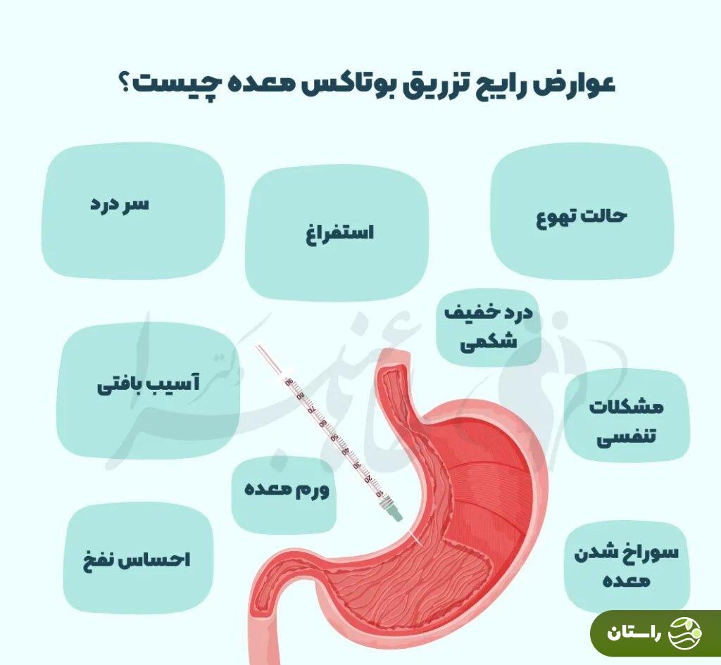 بوتاکس معده چیست و چقدر در کاهش وزن موثر است؟