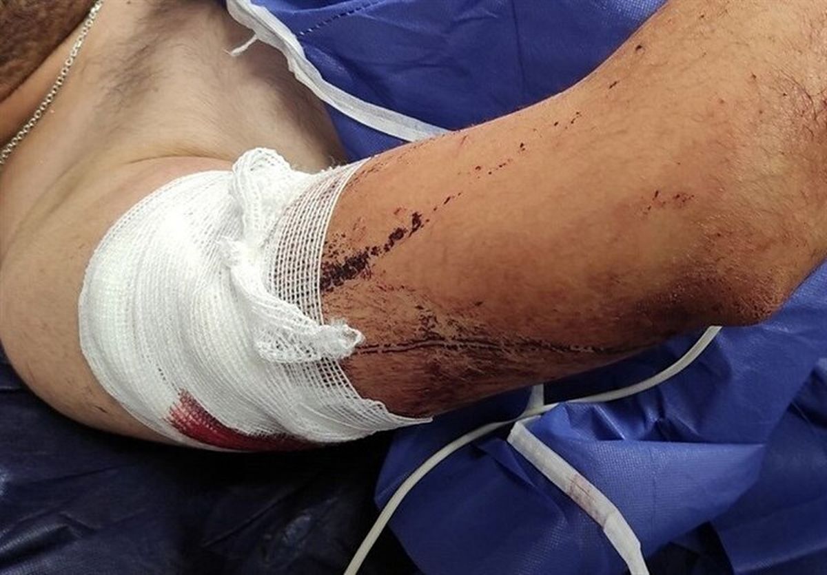 زورگیری خشن از یک دانشجو در پارکی در گرگان زورگیری خشن از یک دانشجو در پارکی در گرگان