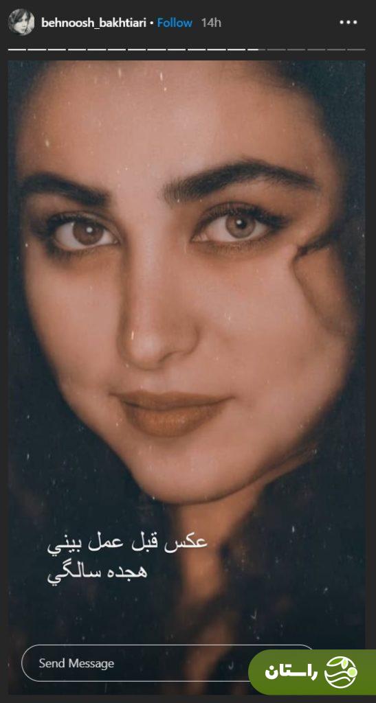 بهنوش بختیاری: قبل از عمل شکل آنجلینا جولی بودم، خیلی خوشگل بودم + ویدئو بهنوش بختیاری: قبل از عمل شکل آنجلینا جولی بودم، خیلی خوشگل بودم + ویدئو