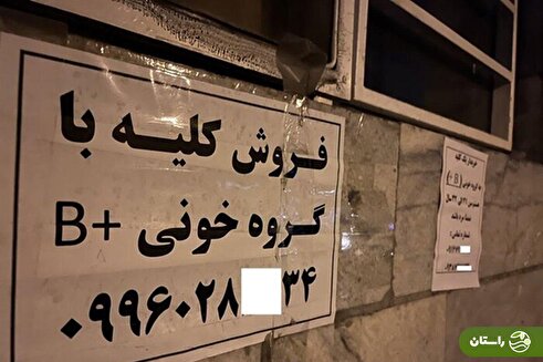 جزییات تکان‌دهنده از فروش کلیه ۷۰میلیاردی در تهران!