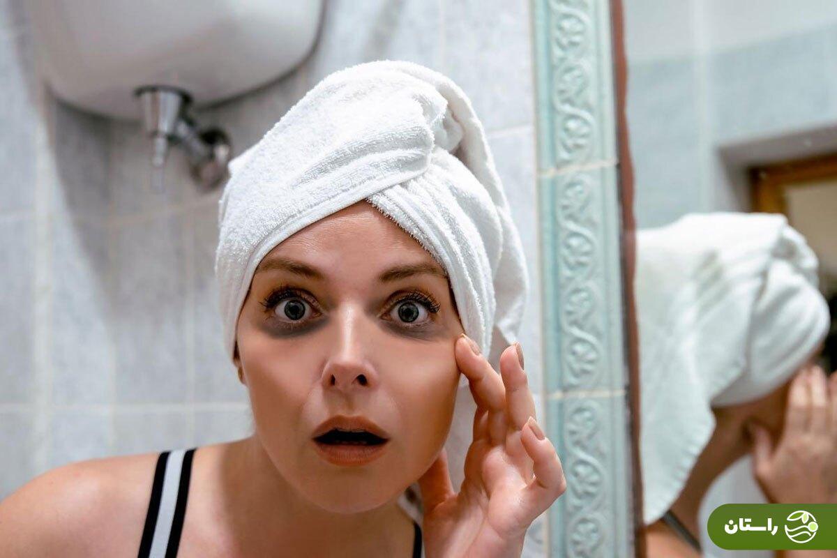 شش راه‌حل برای از بین بردن پف و تیرگی زیر چشم