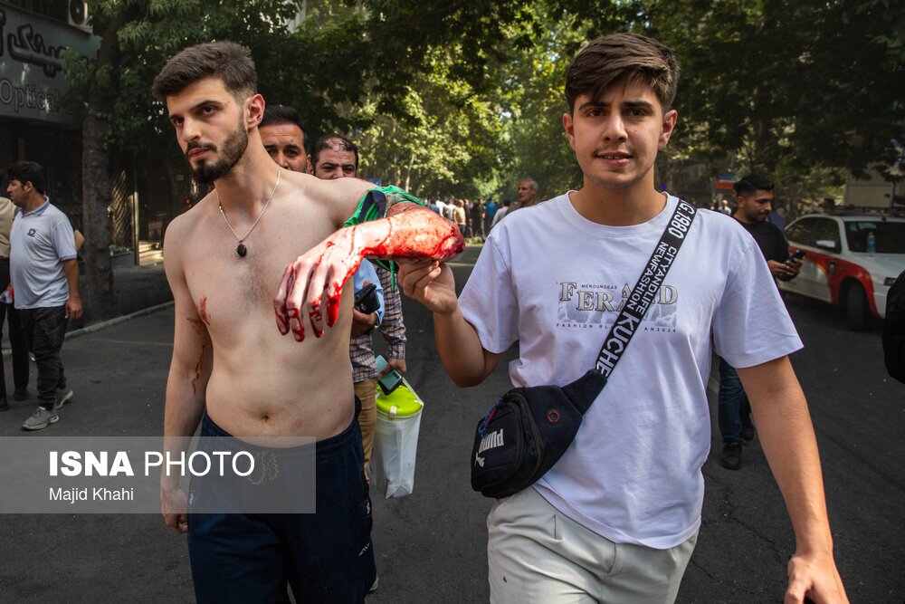 تصاویر‌ | زخمی شدن گودکان و غیرنظامیان در حمله اسرائیل به تهران