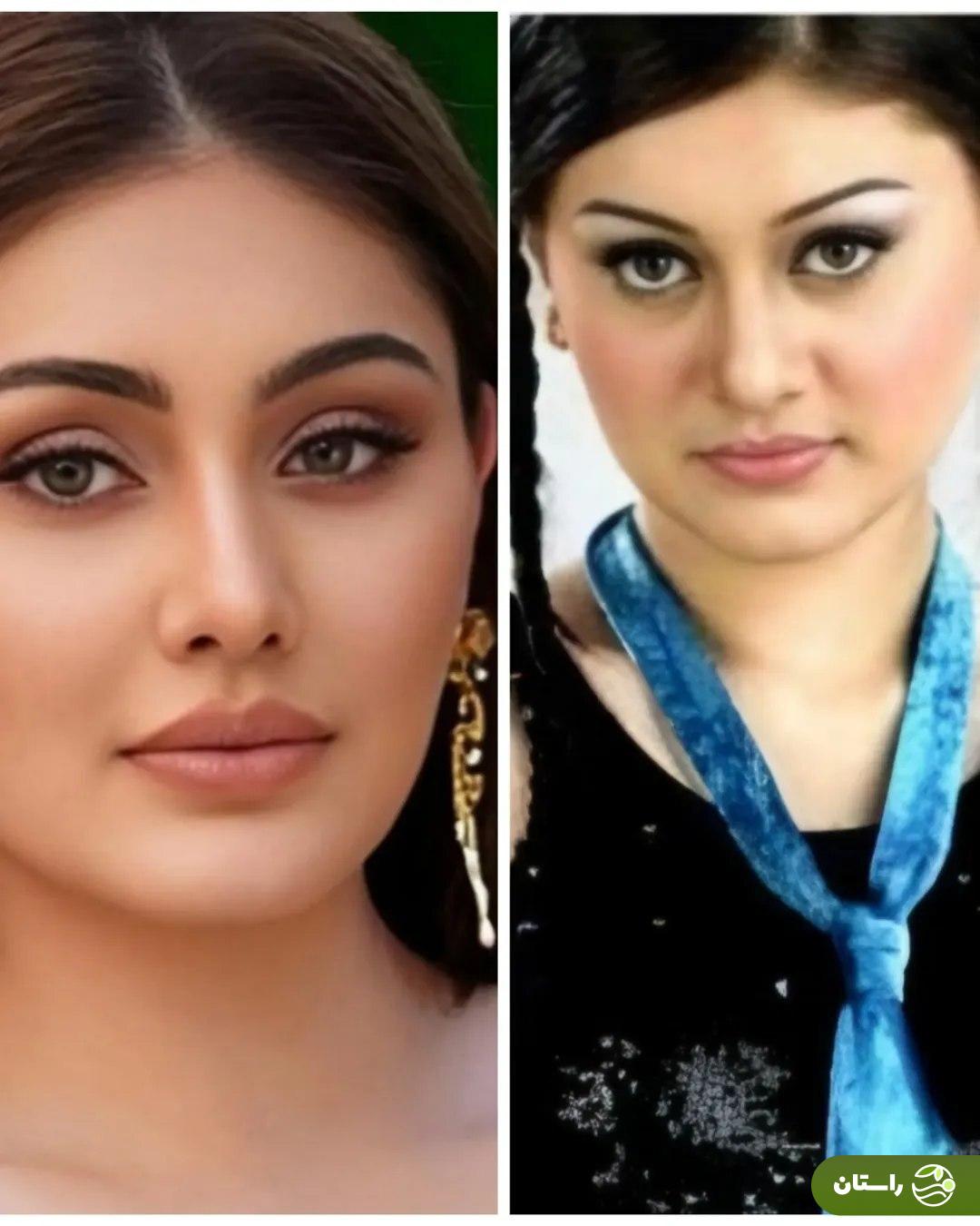 مرگ شفالی زاریوالا بازیگر ۴۲ ساله و مشهور هندی پس از تزریق‌های ضدپیری + تصاویر