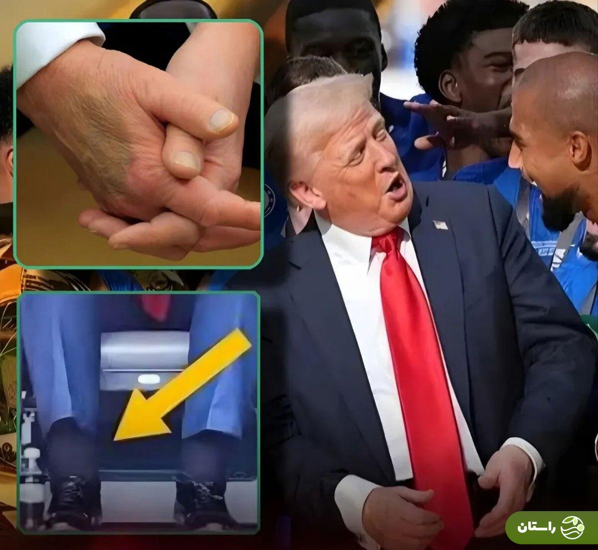 علت ورم دست و پای دونالد ترامپ مشخص شد؛ بیماری رئیس جمهور آمریکا چیست؟ علت ورم دست و پای دونالد ترامپ مشخص شد؛ بیماری رئیس جمهور آمریکا چیست؟