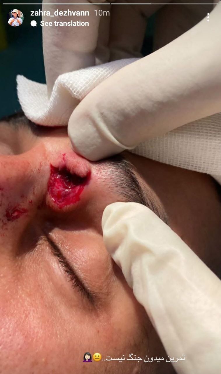 عکس +16 | حادثه دلخراش برای علی علیپور و استوری جنجالی همسرش! عکس +16 | حادثه دلخراش برای علی علیپور و استوری جنجالی همسرش!