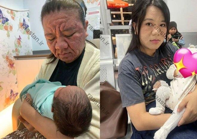 حیرت جهان از تغییرات شدید ظاهری زن ۲۸ ساله در دوران بارداری حیرت جهان از تغییرات شدید ظاهری زن ۲۸ ساله در دوران بارداری