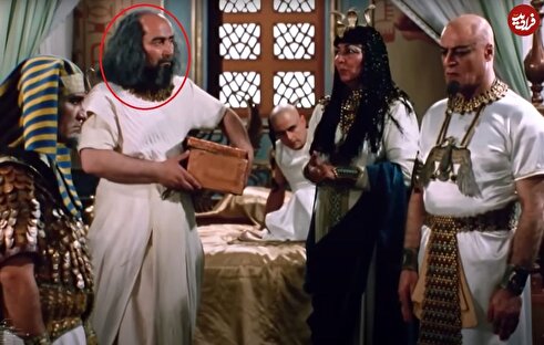 عکس | تغییر چهره عجیب؛ بازیگر سریال یوسف پیامبر به سرطان مبتلا شد