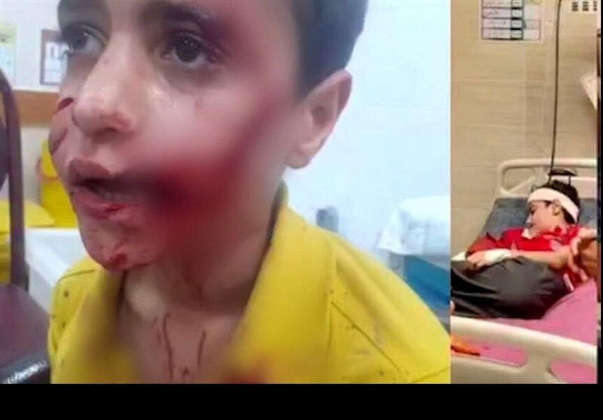 جان باختن کودک ۱۰ ساله بر اثر حمله سگ‌های ولگرد