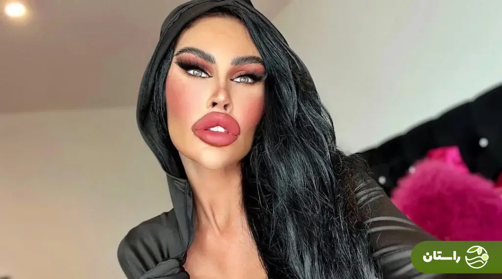 (تصاویر) ظاهر جدید «باربی انسانی»؛ این زن استرالیایی ۲۰۰،۰۰۰ دلار صرف جراحی زیبایی کرده است