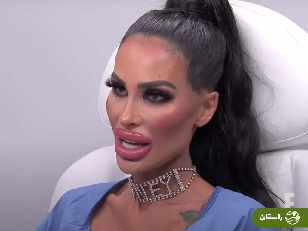 (تصاویر) ظاهر جدید «باربی انسانی»؛ این زن استرالیایی ۲۰۰،۰۰۰ دلار صرف جراحی زیبایی کرده است