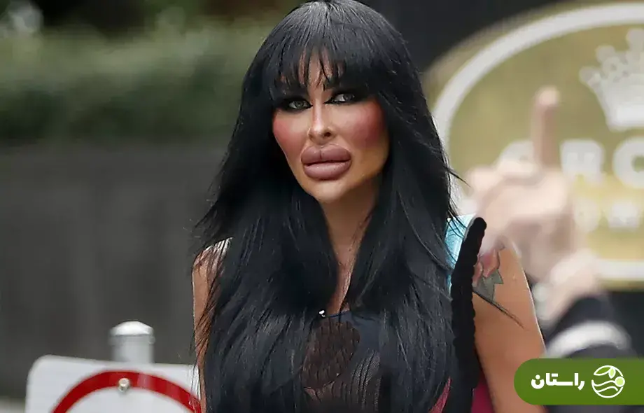 (تصاویر) ظاهر جدید «باربی انسانی»؛ این زن استرالیایی ۲۰۰،۰۰۰ دلار صرف جراحی زیبایی کرده است