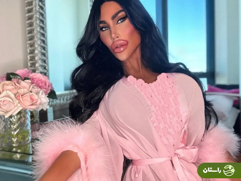 (تصاویر) ظاهر جدید «باربی انسانی»؛ این زن استرالیایی ۲۰۰،۰۰۰ دلار صرف جراحی زیبایی کرده است