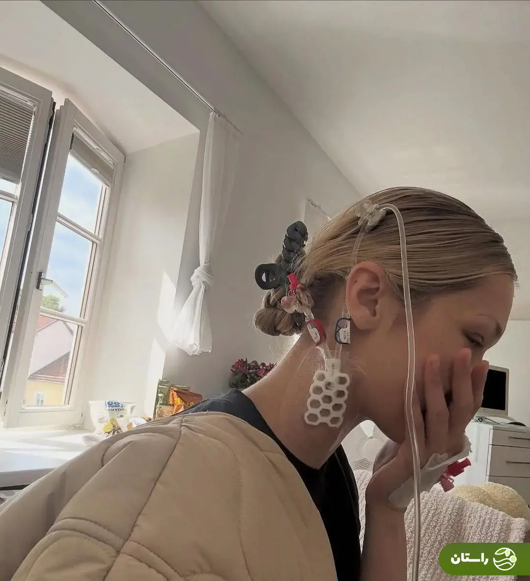 تصاویر شوکه‌کننده از مدل مشهور آمریکایی؛ بیماری بلا حدید چیست؟