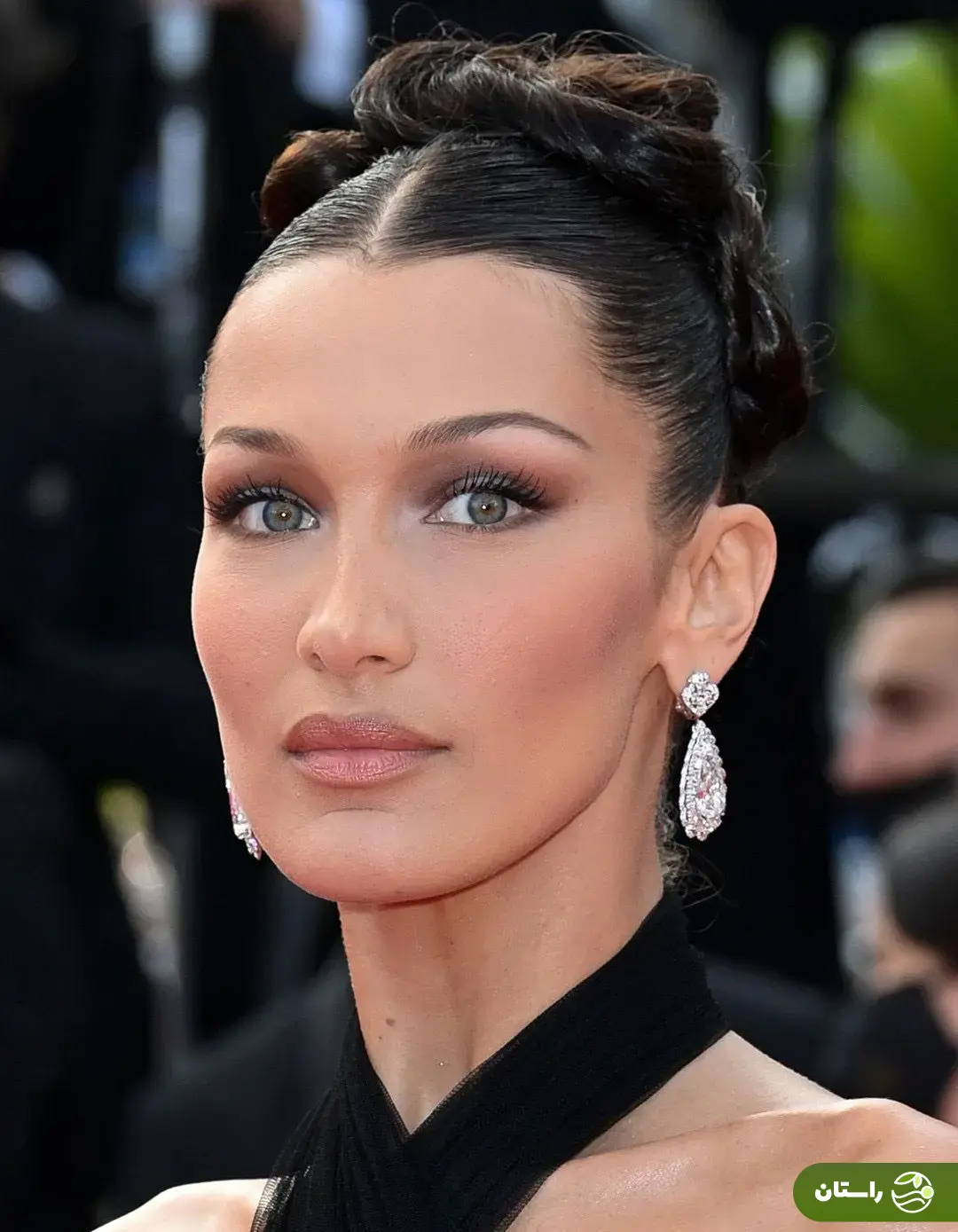 تصاویر شوکه‌کننده از مدل مشهور آمریکایی؛ بیماری بلا حدید چیست؟