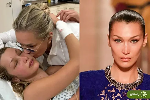 تصاویر شوکه‌کننده از مدل مشهور آمریکایی؛ بیماری بلا حدید چیست؟