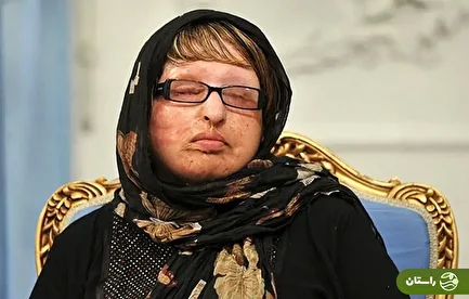(ویدئو) ماجرای نابینا شدن ناگهانی آمنه در اسپانیا