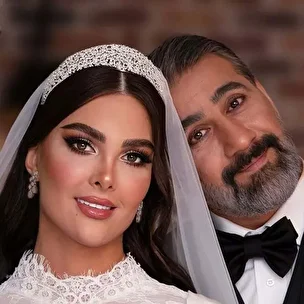 آلبوم تصاویر آتلیه‌ای جشن عروسی محمد نادری و همسرش «الناز»