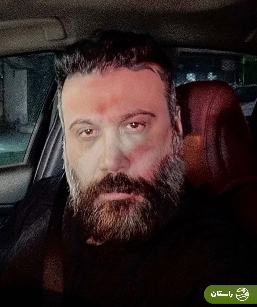 (عکس) چهره شکسته محسن چاوشی در عکس جدیدش جلب‌توجه کرد