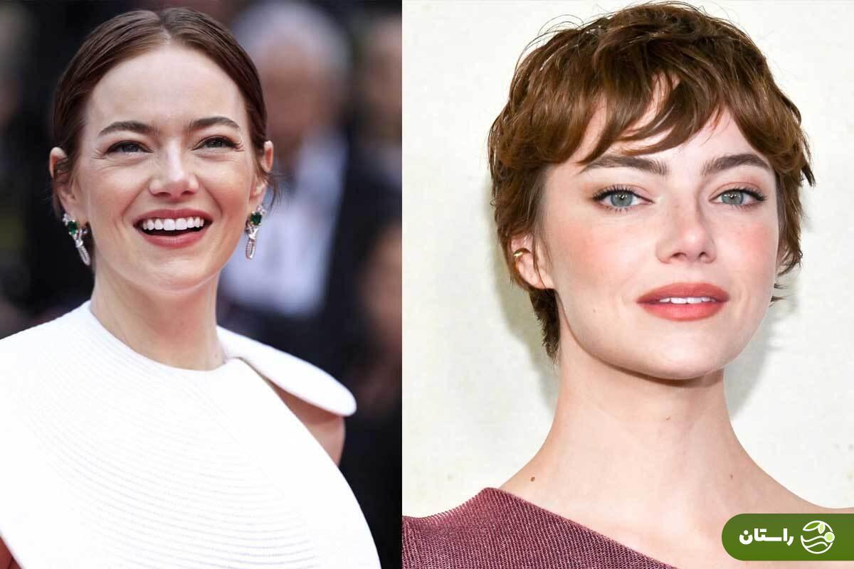 اما استون بر اساس نسبت طلایی یونان باستان زیباترین زن جهان شد  رتبه دوم و سوم زیباترین زن از آن کیست؟