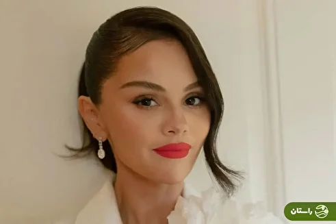 (عکس) تغییر چهره سلنا گومز خبرساز شد