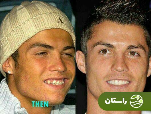 (عکس) تونل زمان: گذشته تا امروز کریستیانو رونالدو ؛ از جوجه اردک زشت تا فوتبالیست میلیاردر خوشتیپ و جذاب (عکس) تونل زمان: گذشته تا امروز کریستیانو رونالدو ؛ از جوجه اردک زشت تا فوتبالیست میلیاردر خوشتیپ و جذاب