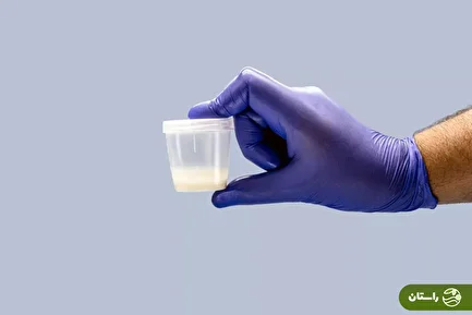 اهداکننده اسپرم حامل ژن سرطانی؛ نزدیک به ۲۰۰ کودک در خطر