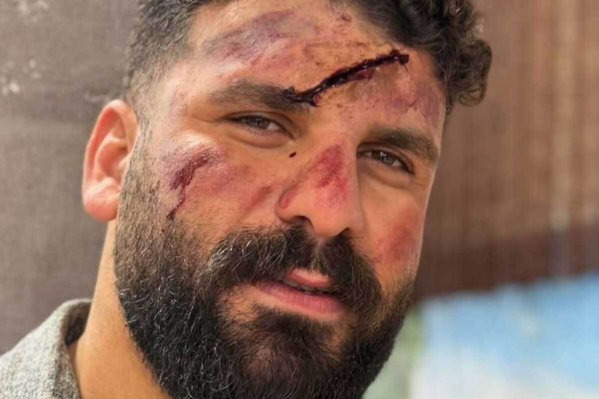 میلاد کرمی ملقب «وضعتان چونه» بلاگر معروف در کوهستان سقوط کرد + عکس