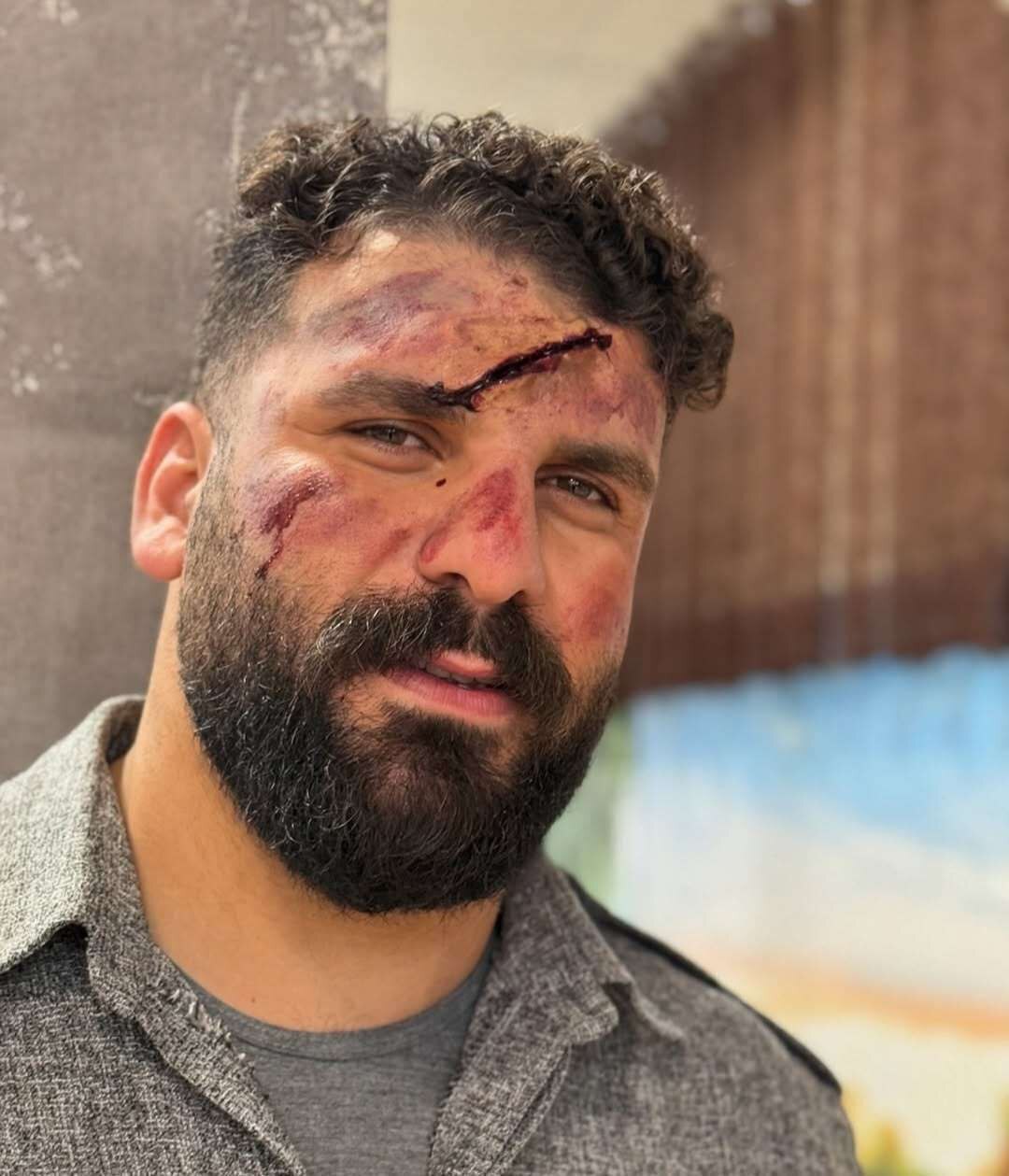 میلاد کرمی ملقب «وضعتان چونه» بلاگر معروف در کوهستان سقوط کرد + عکس میلاد کرمی ملقب «وضعتان چونه» بلاگر معروف در کوهستان سقوط کرد + عکس