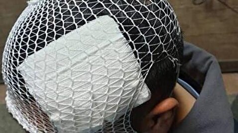 پرتاب لیوان از سوی معلم، یک دانش‌آموز را راهی بیمارستان کرد