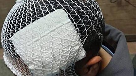 پرتاب لیوان از سوی معلم، یک دانش‌آموز را راهی بیمارستان کرد