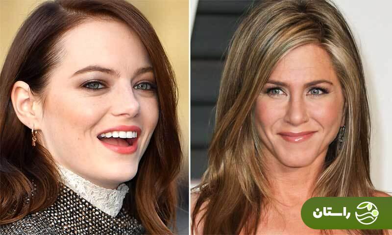 داشتن قوز بینی یا یک دماغِ طبیعی: ترند برتر سال ۲۰۲۶/ چرا معیارهای جهانی زیبایی به دماغ سربالا پشت کرده است؟ داشتن قوز بینی یا یک دماغِ طبیعی: ترند برتر سال ۲۰۲۶/ چرا معیارهای جهانی زیبایی به دماغ سربالا پشت کرده است؟