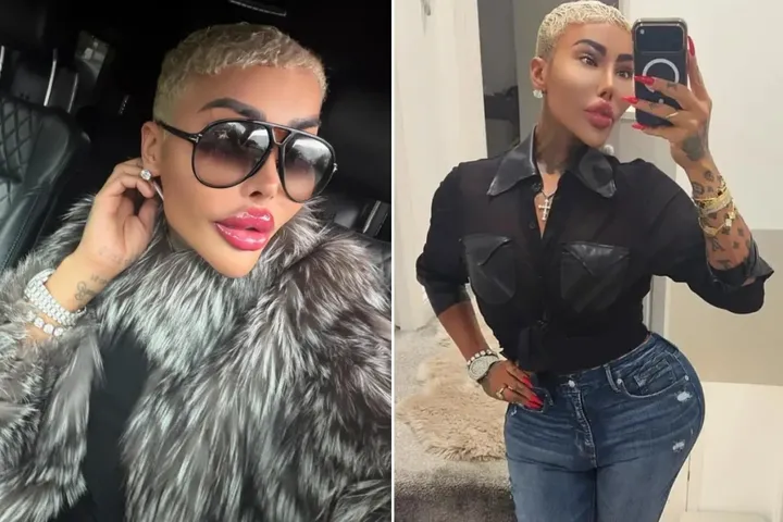 (عکس) مرگ مشکوک زن شیفته کیم کارداشیان ملقب به «سلطان لب» پس از لیفت باسن برزیلی