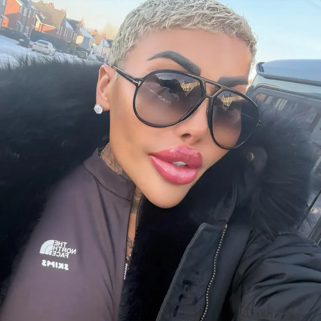 مرگ مشکوک زن شیفته کیم کارداشیان ملقب به «سلطان لب» مرگ مشکوک زن شیفته کیم کارداشیان ملقب به «سلطان لب»