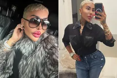 (عکس) مرگ مشکوک زن شیفته کیم کارداشیان ملقب به «سلطان لب» پس از لیفت باسن برزیلی