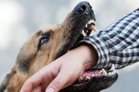 تصویر +18 | عکس دلخراش از حمله سگ به کودک خوزستانی